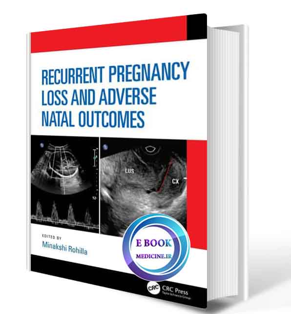 دانلود کتابRecurrent Pregnancy Loss and Adverse Natal Outcomes 2020(ORIGINAL PDF)